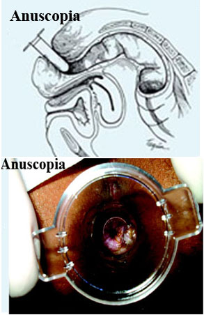 Exame de Anuscopia e Retossigmoidoscopia [NEW] – Cedusp – Exames Guarulhos